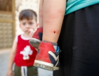 تحذير لسكان اسطنبول.. البعوض يهاجم أجساد الأطفال بشراسة (صور)