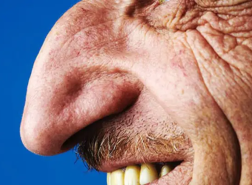 شاهد الصور.. رجل تركي لديه أكبر أنف في العالم
